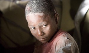 A-child-injured-in-an-ear-001 An injured child at a Hotel in Port-au-Prince, Haiti Photograph: Ivanoh Demers/AP