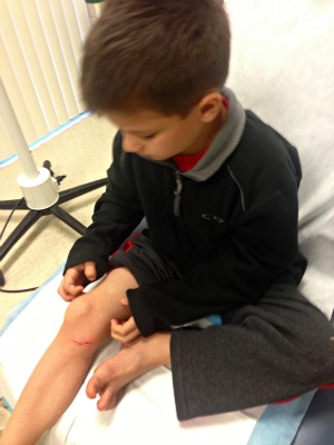 cuts and scrapes